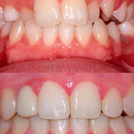 Clínica Dental Doctor Catalán correcciones dentales 10